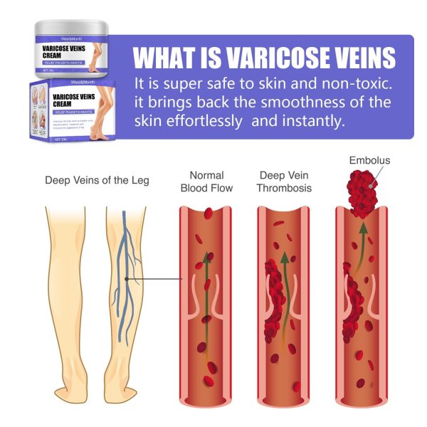 🔥LAST DAY Promotion 49% OFF🔥Vein Care Fading Cream【Buy 1 Get 1 Free】