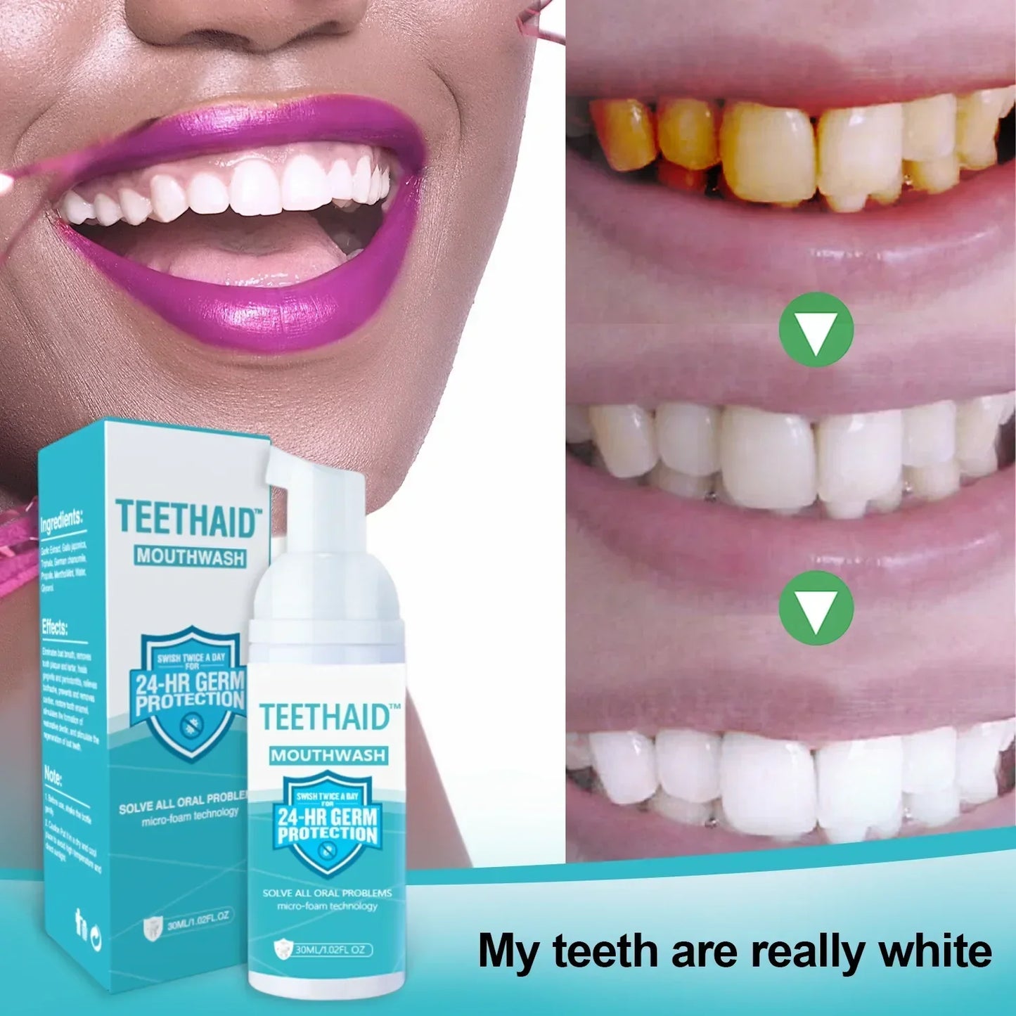 Teethaid™ 🔥🔥Mouthwash, Calculus Removal, Teeth Whitening, Healing Mouth Ulcers, Eliminating Bad Breath, Preventing and Healing Caries