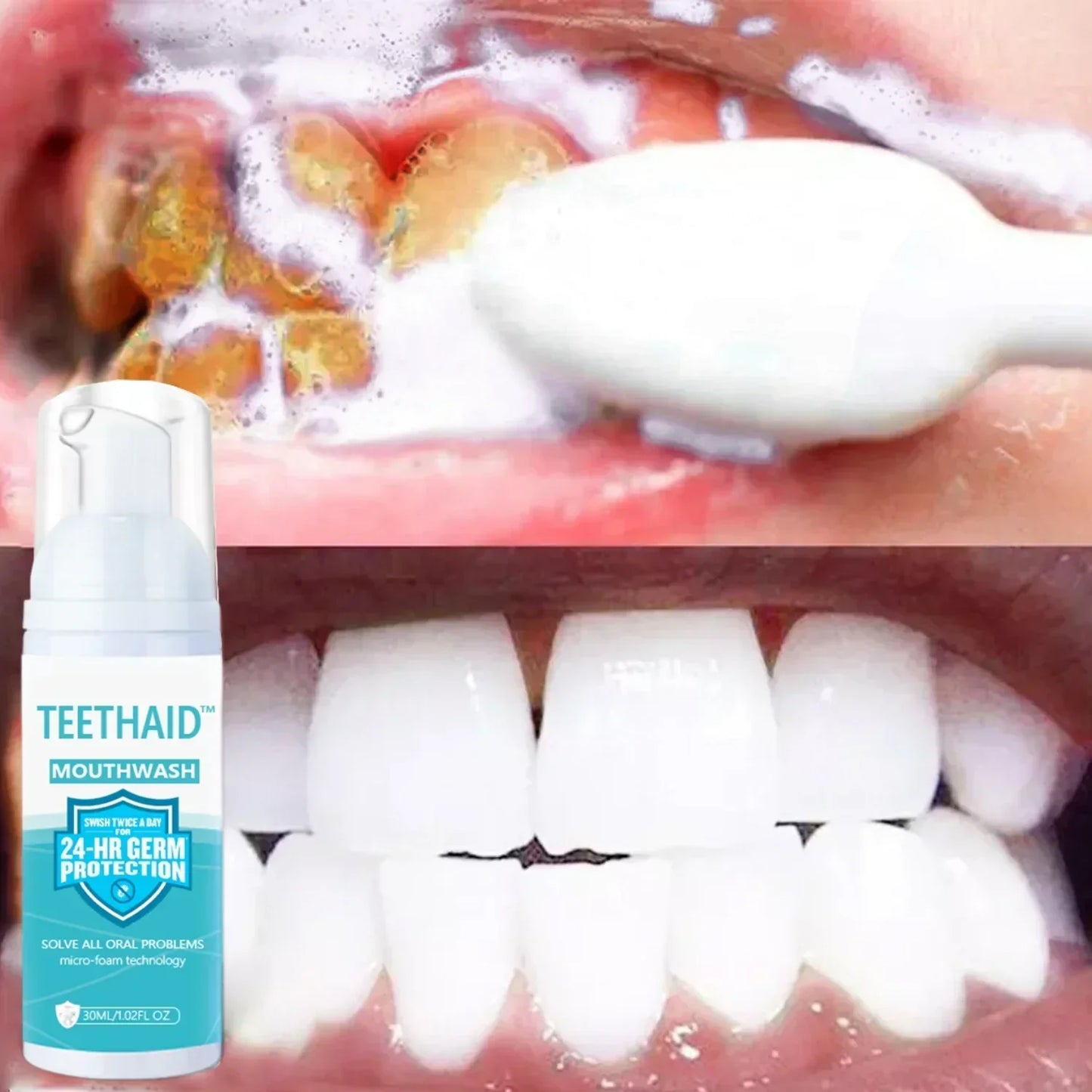 Teethaid™ 🔥🔥Mouthwash, Calculus Removal, Teeth Whitening, Healing Mouth Ulcers, Eliminating Bad Breath, Preventing and Healing Caries