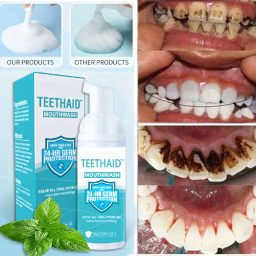 Teethaid™ 🔥🔥Mouthwash, Calculus Removal, Teeth Whitening, Healing Mouth Ulcers, Eliminating Bad Breath, Preventing and Healing Caries