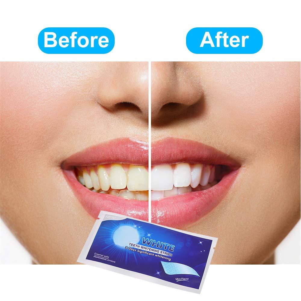 7PCS Teeth Whitening Strips【🇮🇳COD + Local Stock ！！!】