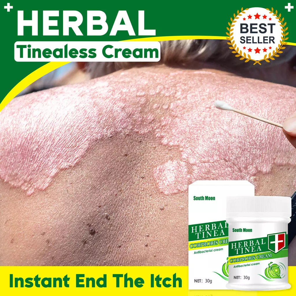 Herbal Skin Anti-Itch Cream